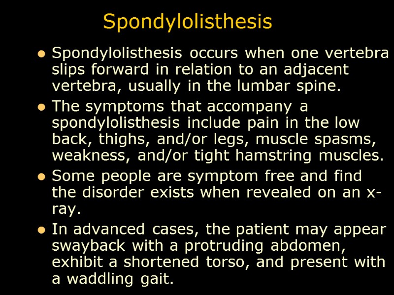 Spondylolisthesis Spondylolisthesis occurs when one vertebra slips forward in relation to an adjacent vertebra,